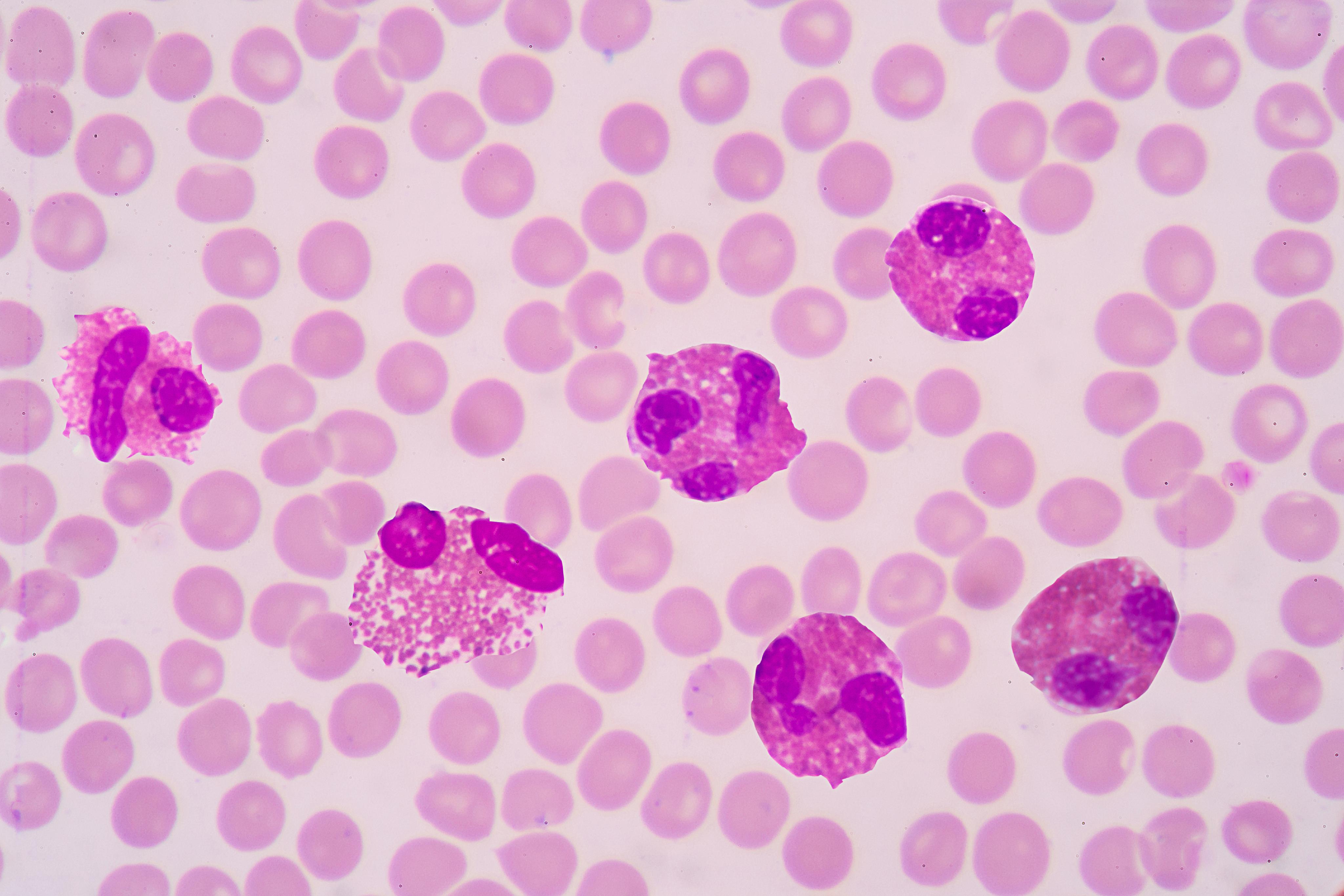 Eosinófilos